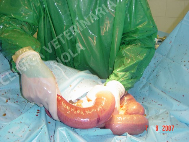 Costipazione colon discendente